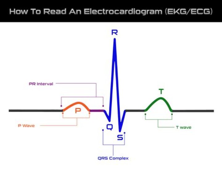 What can affect an ECG